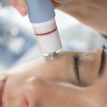 MicroDermabrasion